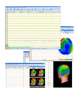 Evidence EEG Gruppenbefundlizenz